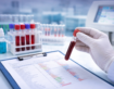 Understanding Common Blood Tests and What They Indicate