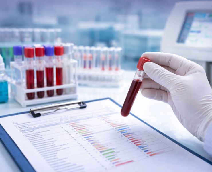 Understanding Common Blood Tests and What They Indicate