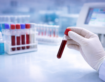 Why Accurate Laboratory Testing Matters for Reliable Diagnosis