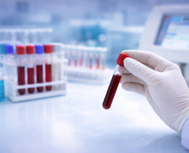 Why Accurate Laboratory Testing Matters for Reliable Diagnosis